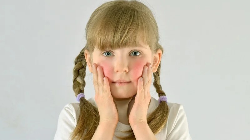 Dầu tía tô có thể gây kích ứng da Dầu tía tô có thể gây kích ứng da