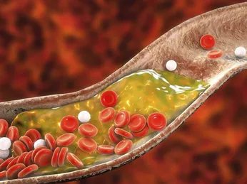 Cholesterol là gì? Có hại cho sức khỏe không?