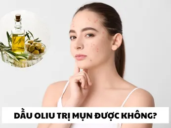 Dầu Ô Liu Trị Mụn Được Không? Hướng Dẫn Sử Dụng Làm Đẹp Da Với Dầu Ô Liu