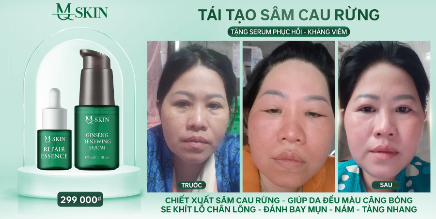 Da khách dùng serum tái tạo da sâm cau rừng mq skin Da khách dùng serum tái tạo da sâm cau rừng mq skin