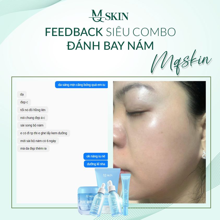 Dùng bộ nám mq skin hết sạch nám Dùng bộ nám mq skin hết sạch nám