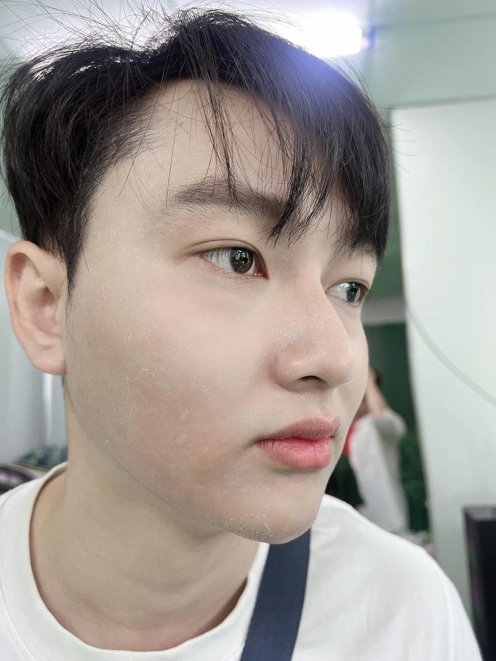 Feedback da khách dùng kem tái tạo nội mô mq skin Feedback da khách dùng kem tái tạo nội mô mq skin