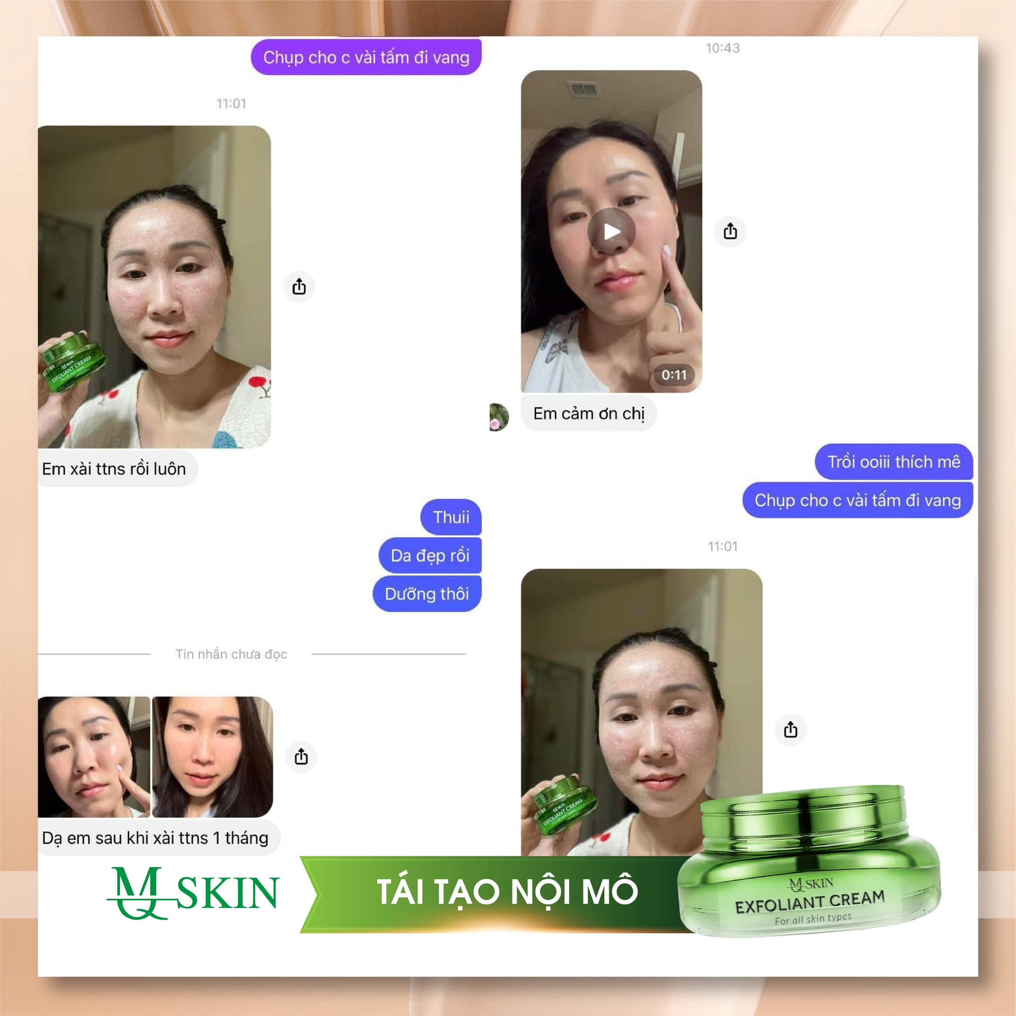 Kem tái tạo da nội mô mq skin bao lâu bong da Kem tái tạo da nội mô mq skin bao lâu bong da