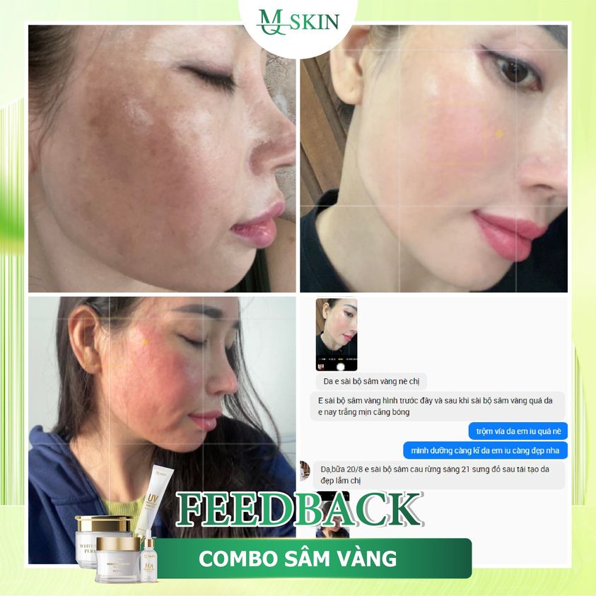 Khách dùng combo kem face sâm vàng mq skin Khách dùng combo kem face sâm vàng mq skin