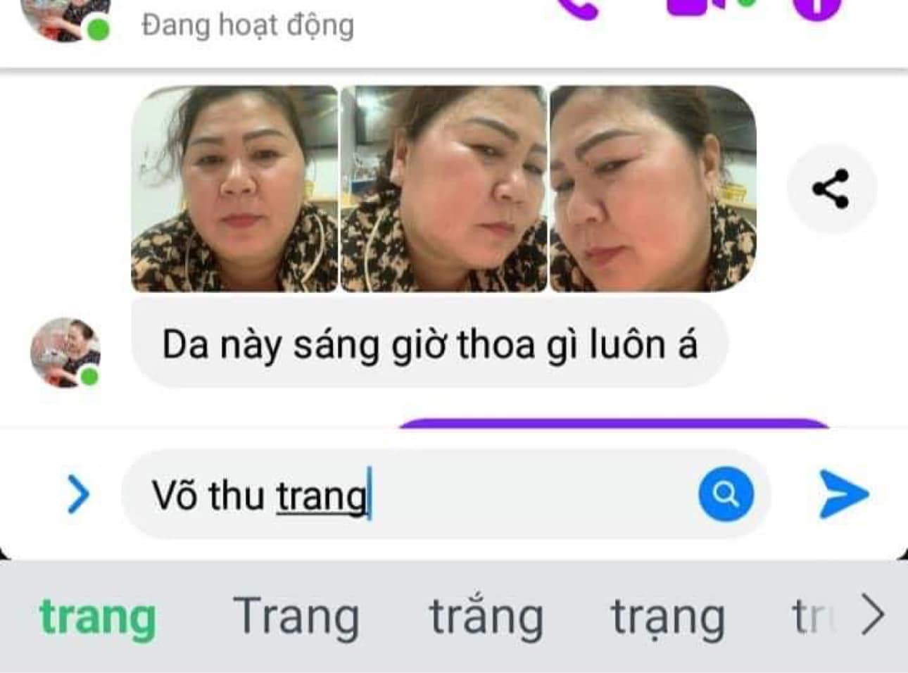 Làn da sau khi dùng bộ nám mq skin Làn da sau khi dùng bộ nám mq skin