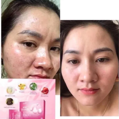 Phản hồi khách dùng bena collagen Phản hồi khách dùng bena collagen