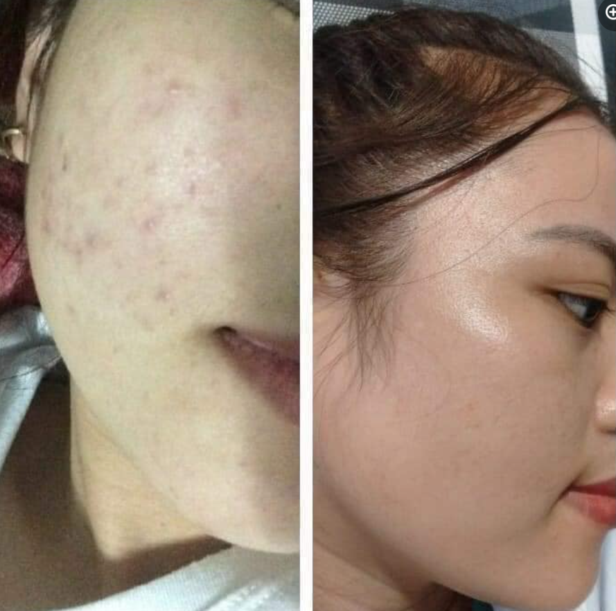 Phản hồi khách hàng dùng bena collagen Phản hồi khách hàng dùng bena collagen
