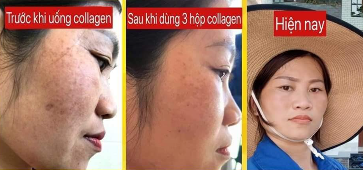 Phản hồi khách hàng dùng bena collagen Phản hồi khách hàng dùng bena collagen