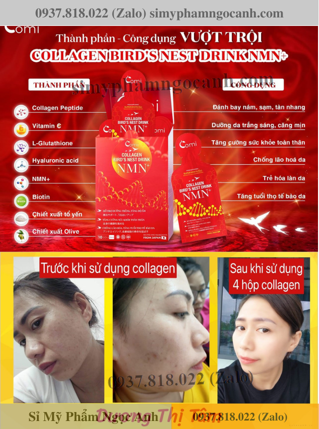 Thành phần công dụng collagen comi yến nmn Thành phần công dụng collagen comi yến nmn
