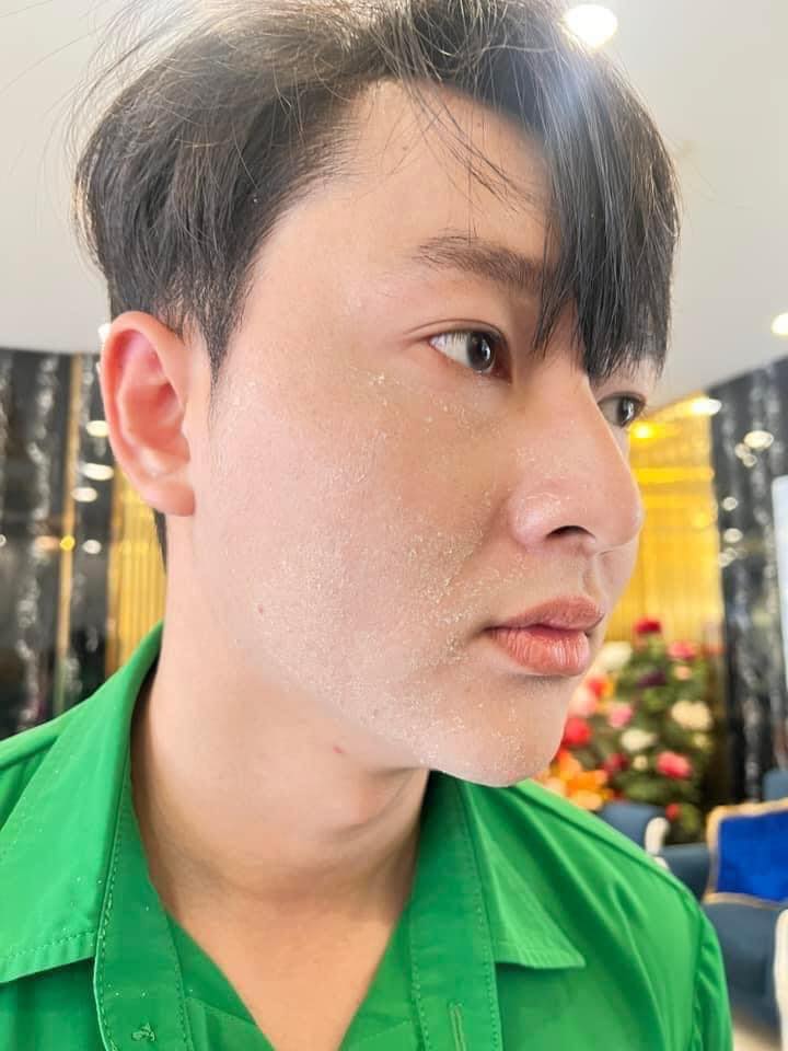 Ưu điểm tái tạo nội mô mq skin Ưu điểm tái tạo nội mô mq skin