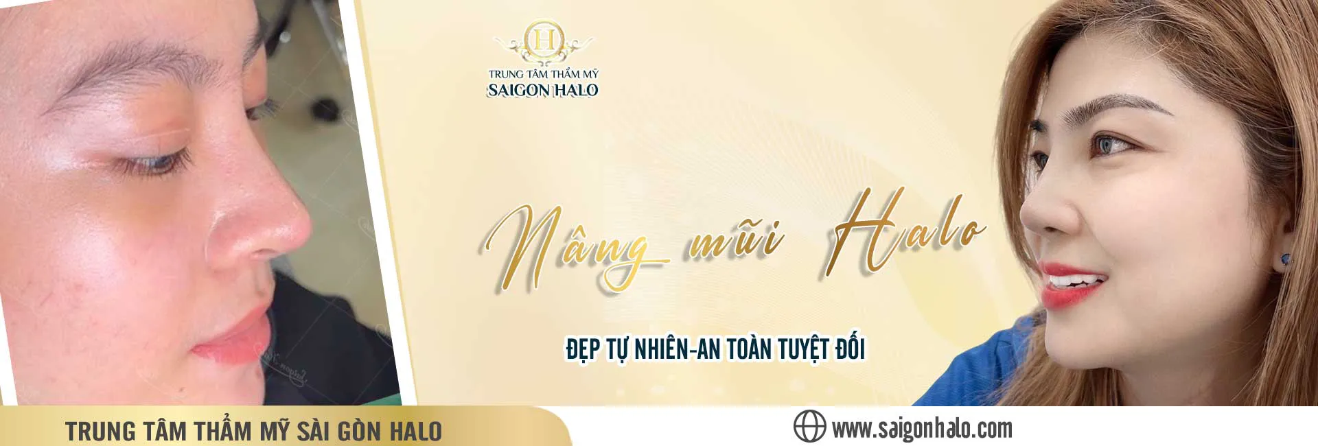 Nâng mũi Halo đẹp tự nhiên tại Thẩm mỹ Sài Gòn Halo