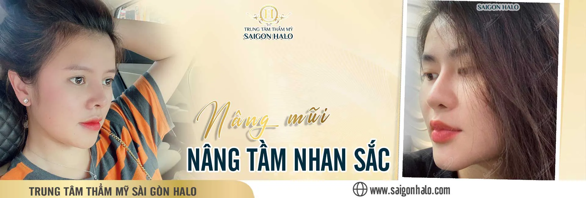 Nâng mũi surgiforn bác sĩ giỏi tại HCM