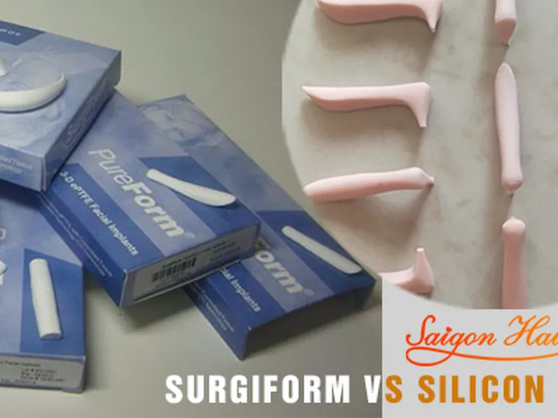 Sự khác nhau giữa nâng mũi sụn silicon và sụn surgiform. Vì sao surgiform là chất liệu nâng mũi cao cấp?
