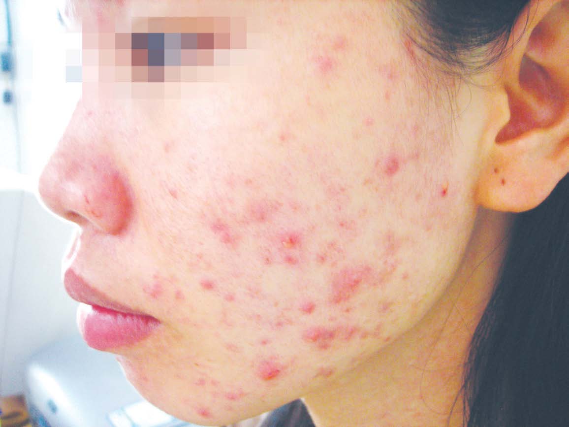 vitamin-b5-doi-voi-lan-da-cua-ban vitamin-b5-doi-voi-lan-da-cua-ban