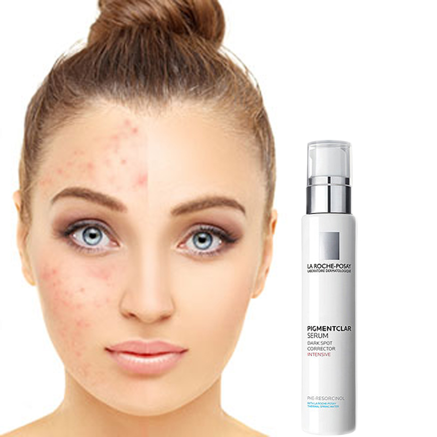 phan-loai-serum-theo-cac-van-de-cua-da phan-loai-serum-theo-cac-van-de-cua-da