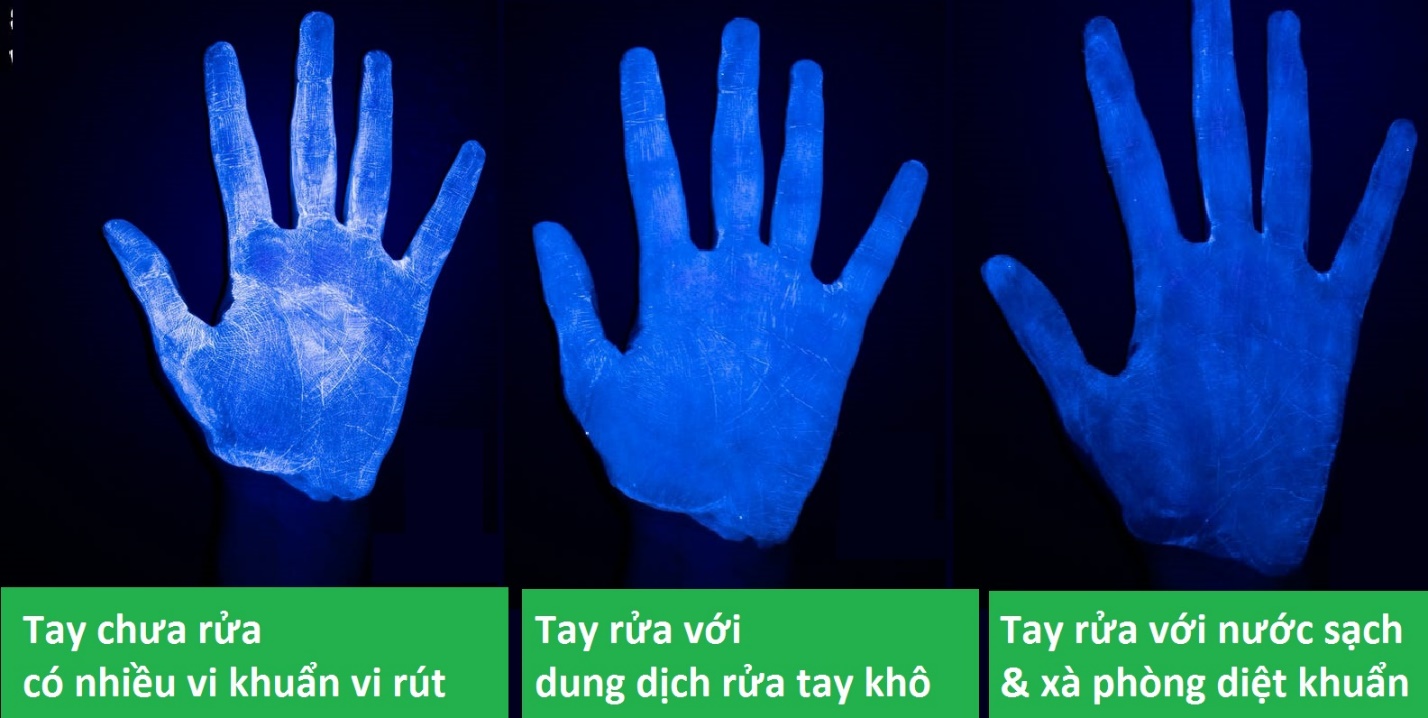 lam-gi-khi-lo-dung-tay-nan-mun-tren-mat lam-gi-khi-lo-dung-tay-nan-mun-tren-mat