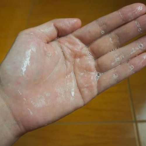 cach-chon-sua-rua-mat cach-chon-sua-rua-mat