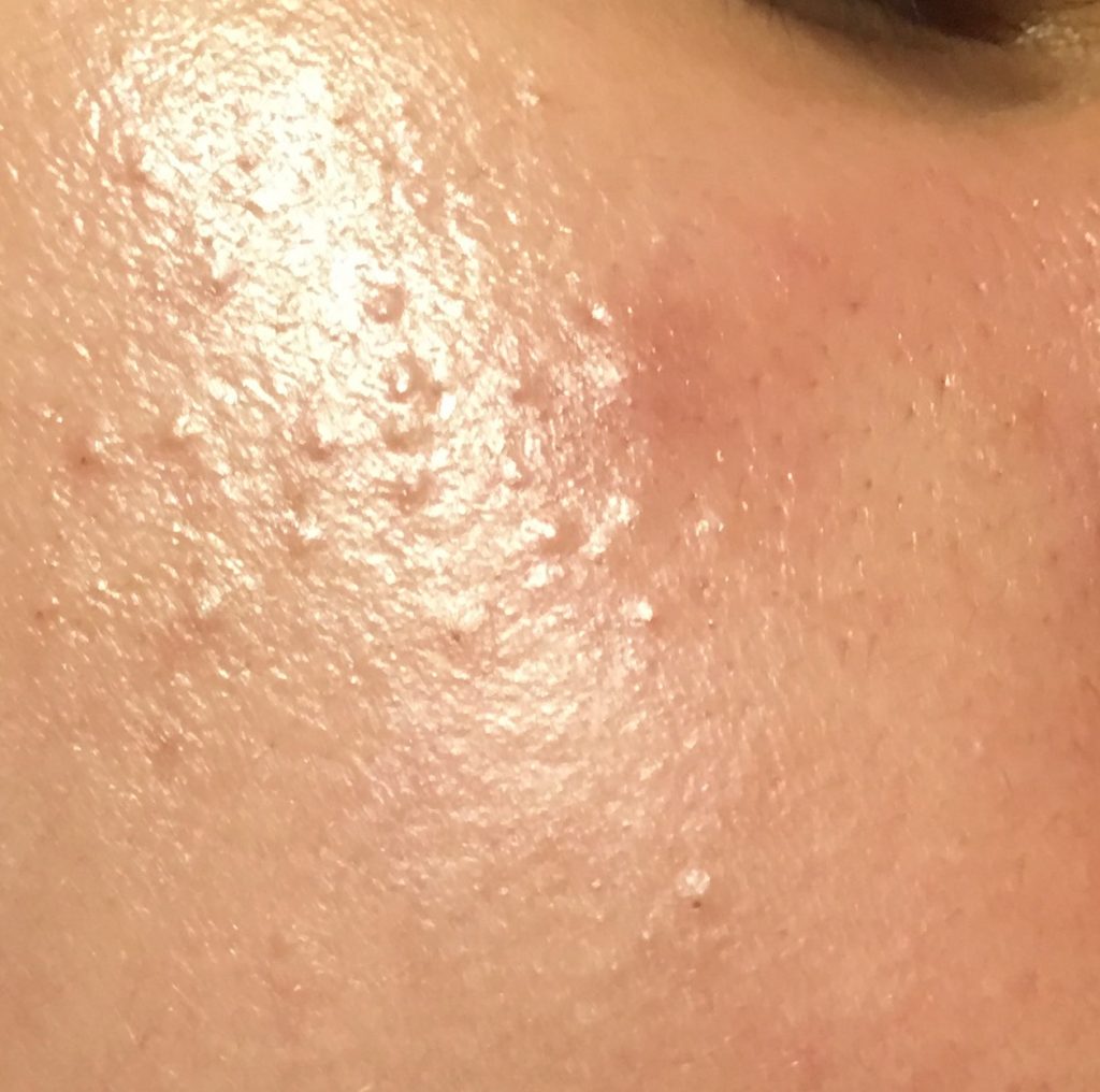 da-thieu-nuoc-da-thieu-am-co-khac-nhau-cach-cham-soc-da-thieu-nuoc-va-da-thieu-am da-thieu-nuoc-da-thieu-am-co-khac-nhau-cach-cham-soc-da-thieu-nuoc-va-da-thieu-am