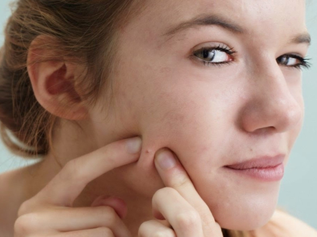 cham-soc-da-mun-o-tuoi-day-thi cham-soc-da-mun-o-tuoi-day-thi