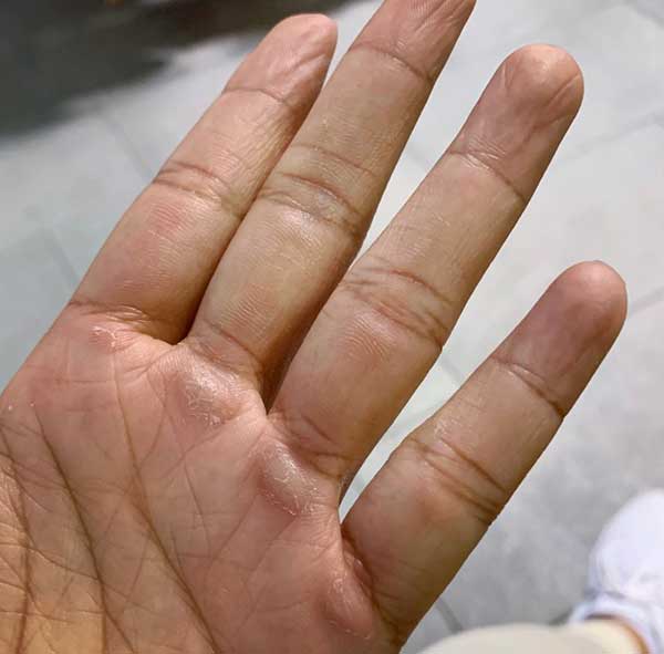 Phan-1-cham-soc-da-tay-va-da-co-co-quan-trong Phan-1-cham-soc-da-tay-va-da-co-co-quan-trong