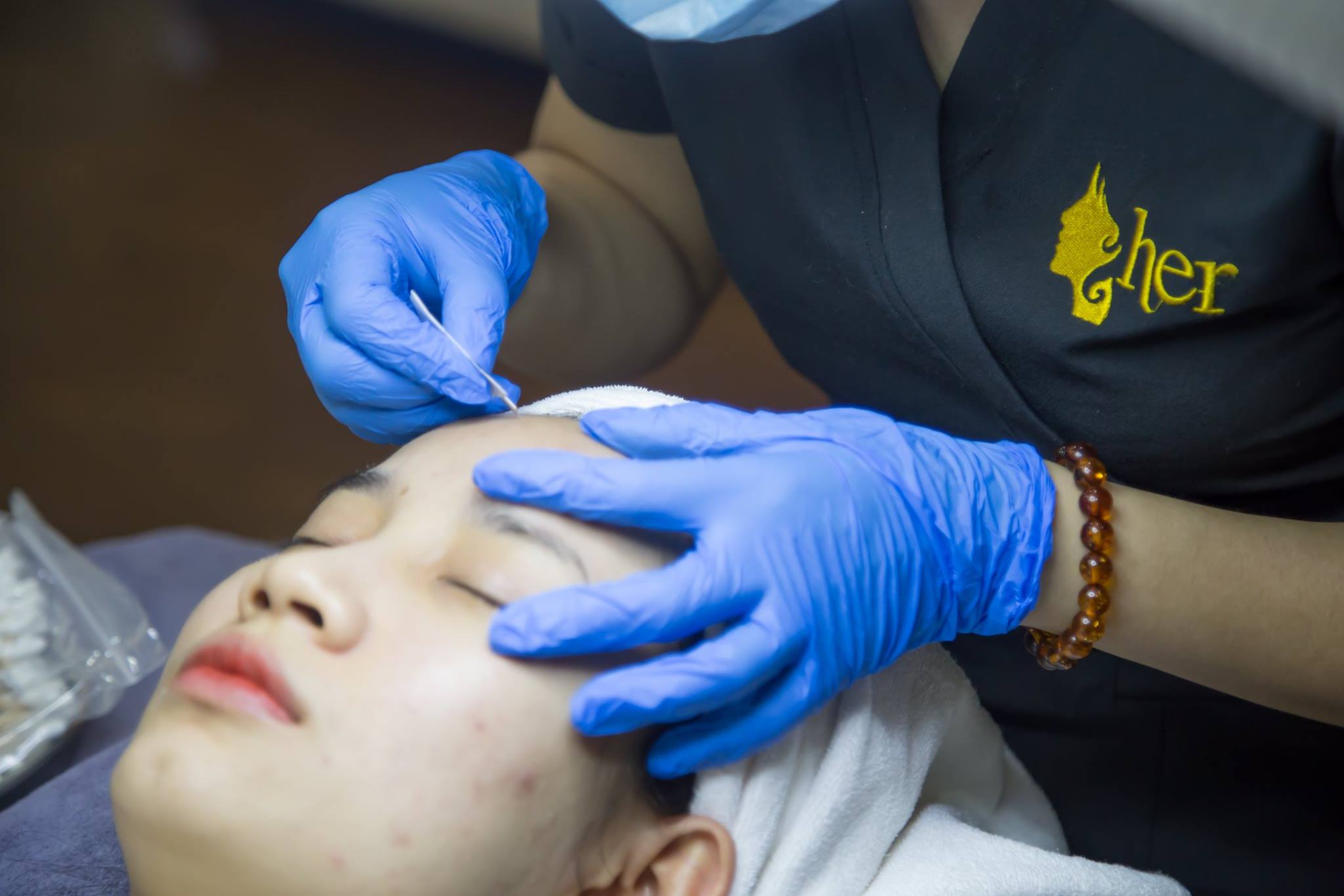 mun-dinh-rau-nguyen-nhan-va-cach-khac-phuc-hieu-qua mun-dinh-rau-nguyen-nhan-va-cach-khac-phuc-hieu-qua