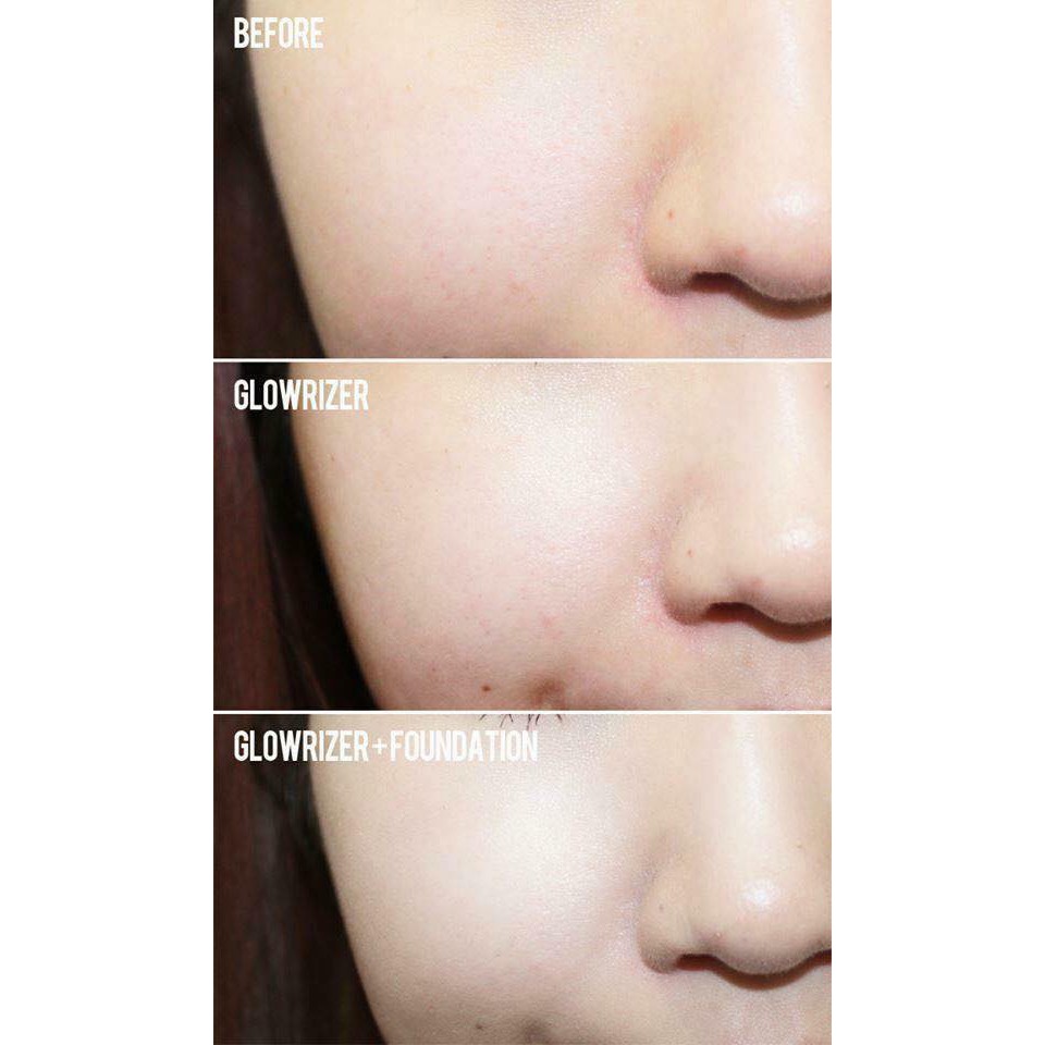 tong-hop-kem-lot-danh-cho-da-dau-mun-nhay-cam tong-hop-kem-lot-danh-cho-da-dau-mun-nhay-cam