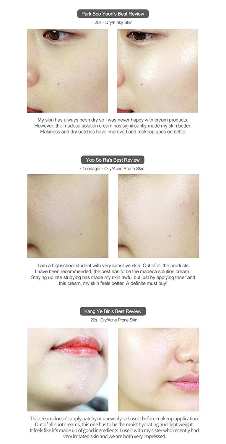 ban-biet-nhung-dieu-gi-ve-lan-da-nhay-cam ban-biet-nhung-dieu-gi-ve-lan-da-nhay-cam