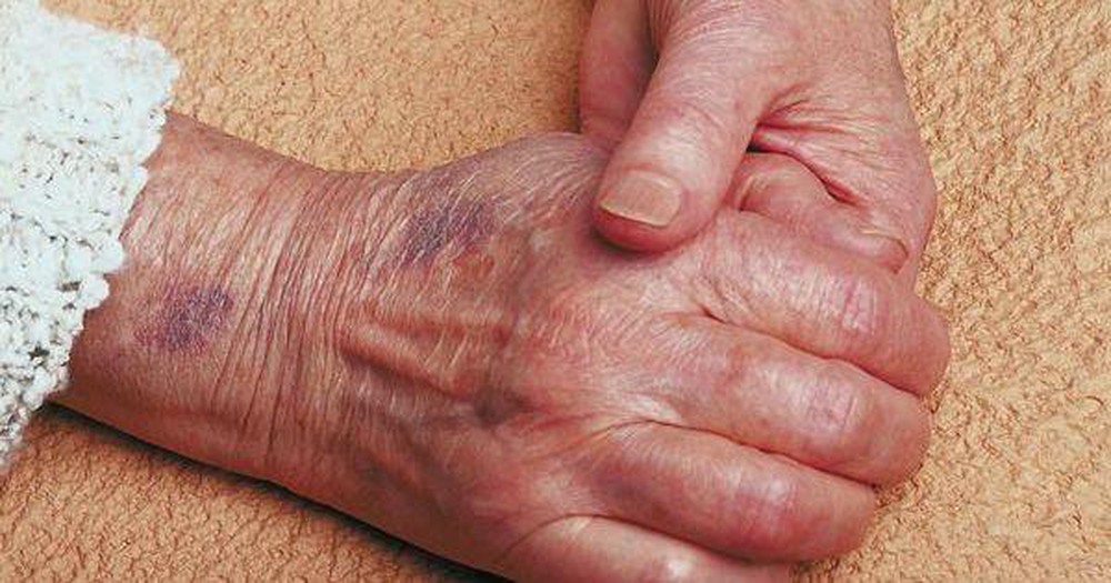 vet-bam-tim-trieu-chung-chan-doan-va-dieu-tri vet-bam-tim-trieu-chung-chan-doan-va-dieu-tri