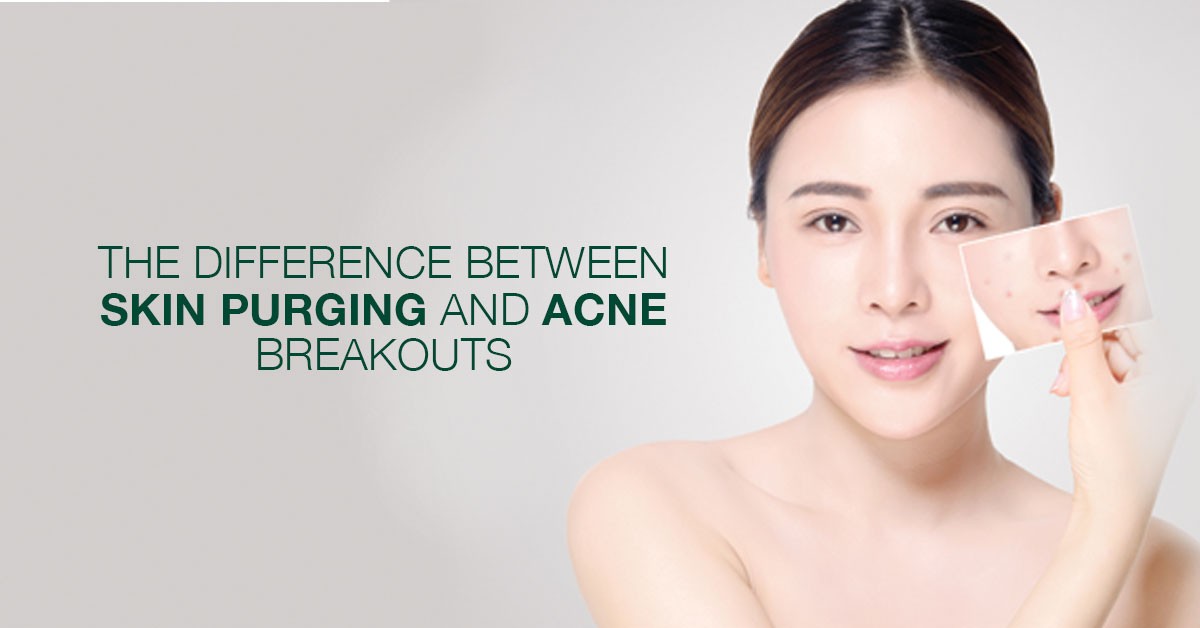 phan-biet-day-mun-va-kich-ung-doi-voi-qua-trinh-cham-soc-da phan-biet-day-mun-va-kich-ung-doi-voi-qua-trinh-cham-soc-da