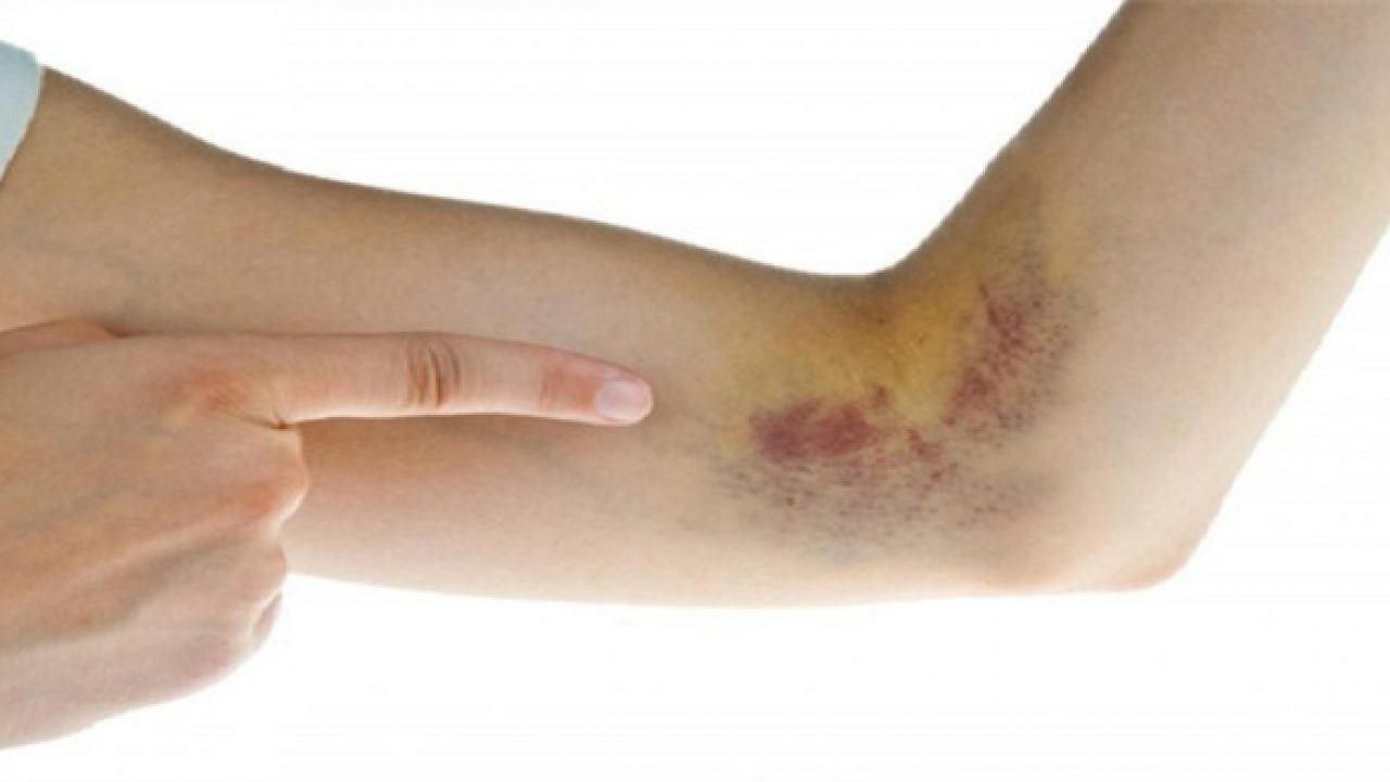 vet-bam-tim-trieu-chung-chan-doan-va-dieu-tri vet-bam-tim-trieu-chung-chan-doan-va-dieu-tri