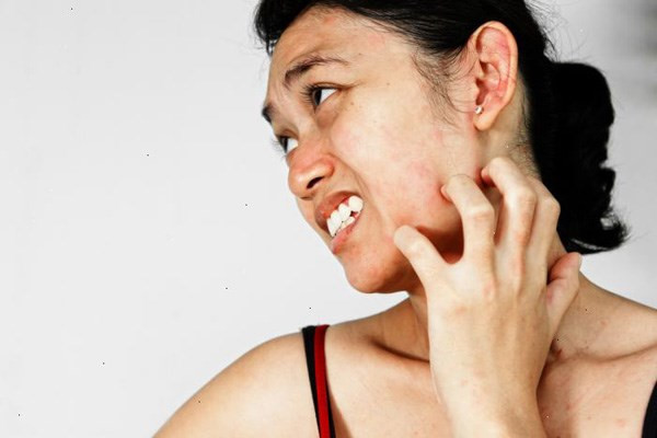 cach-don-gian-nhat-test-di-ung-my-pham-truoc-khi-su-dung-an-toan-va-hieu-qua cach-don-gian-nhat-test-di-ung-my-pham-truoc-khi-su-dung-an-toan-va-hieu-qua