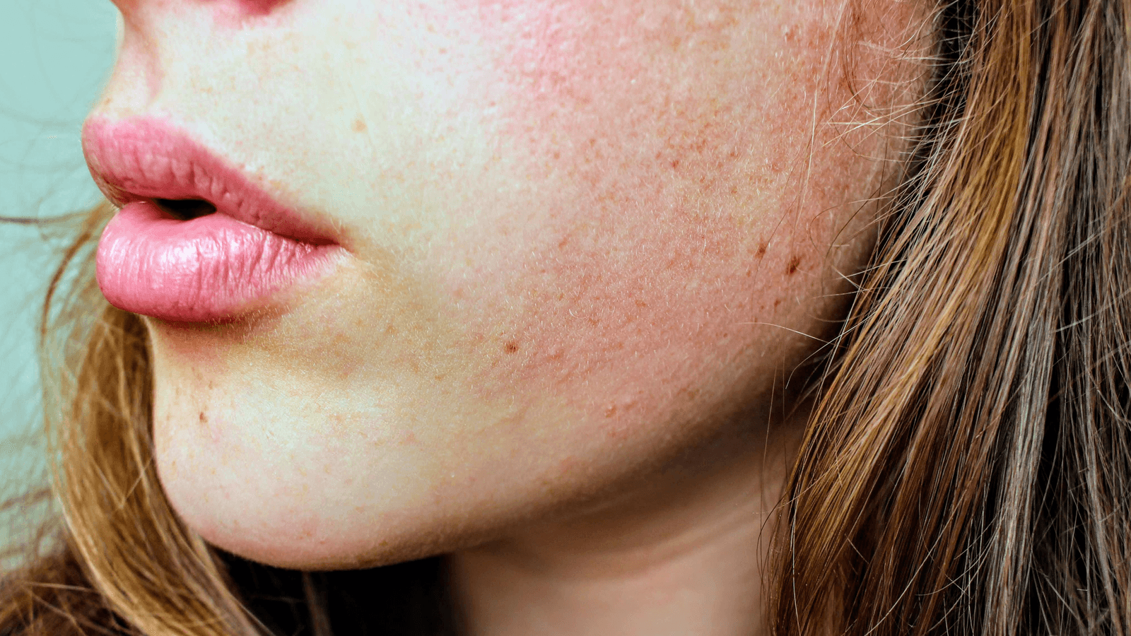 cham-soc-lan-da-mua-dong-trang-hong cham-soc-lan-da-mua-dong-trang-hong