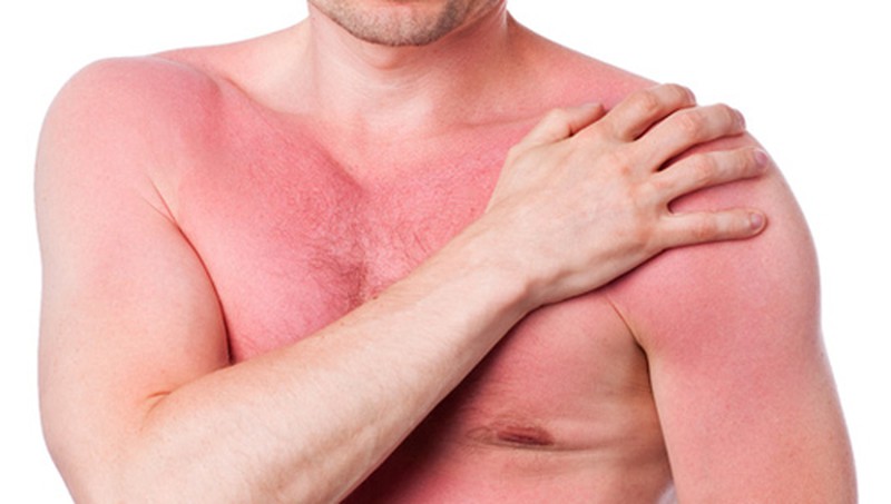 da-bi-kich-ung-thoi-tiet-nguyen-nhan-va-cach-khac-phuc da-bi-kich-ung-thoi-tiet-nguyen-nhan-va-cach-khac-phuc