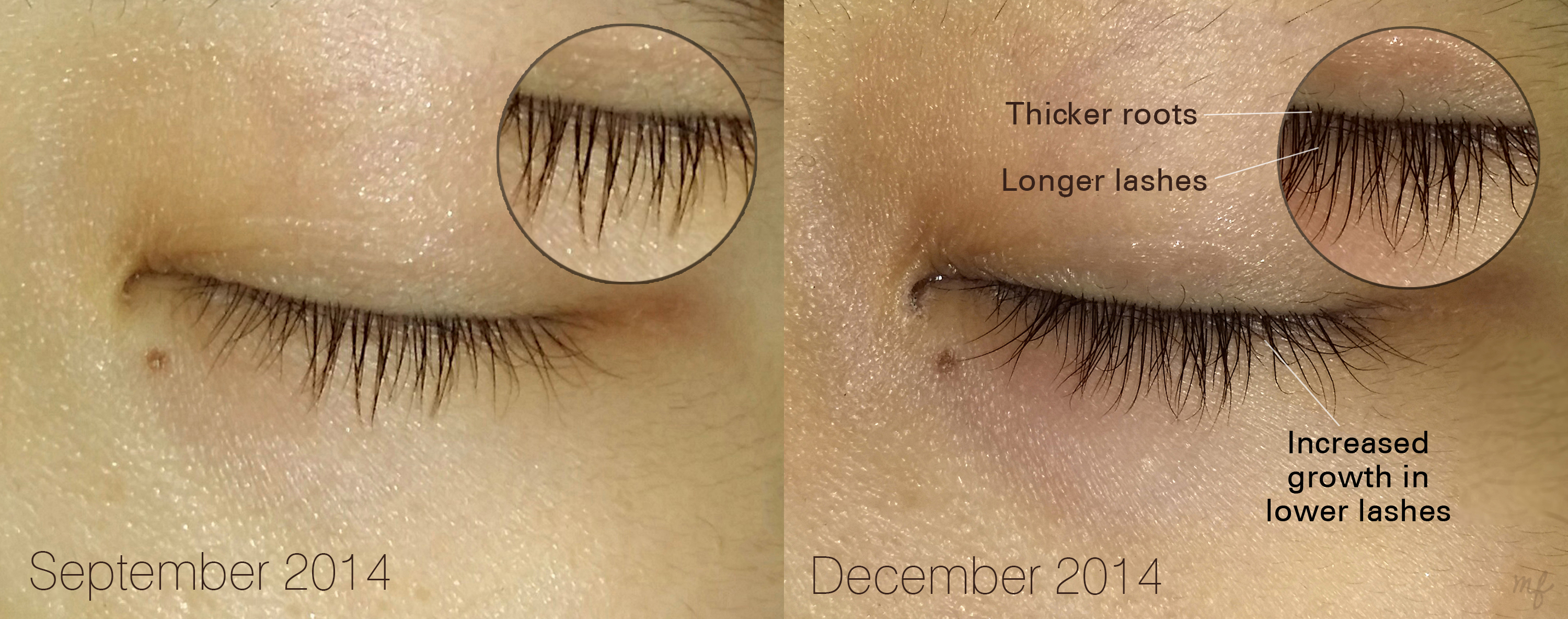 duong-mi-dhc-nhat-ban-hello-kitty-eyelash-tonic duong-mi-dhc-nhat-ban-hello-kitty-eyelash-tonic