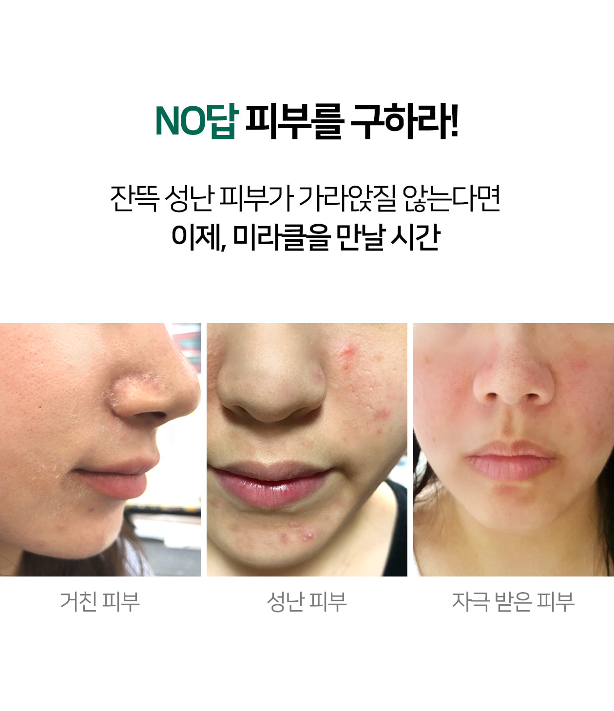 serum-tri-mun-tham-aha-bha-pha-30-days-miracle-cua-some-by-mi serum-tri-mun-tham-aha-bha-pha-30-days-miracle-cua-some-by-mi