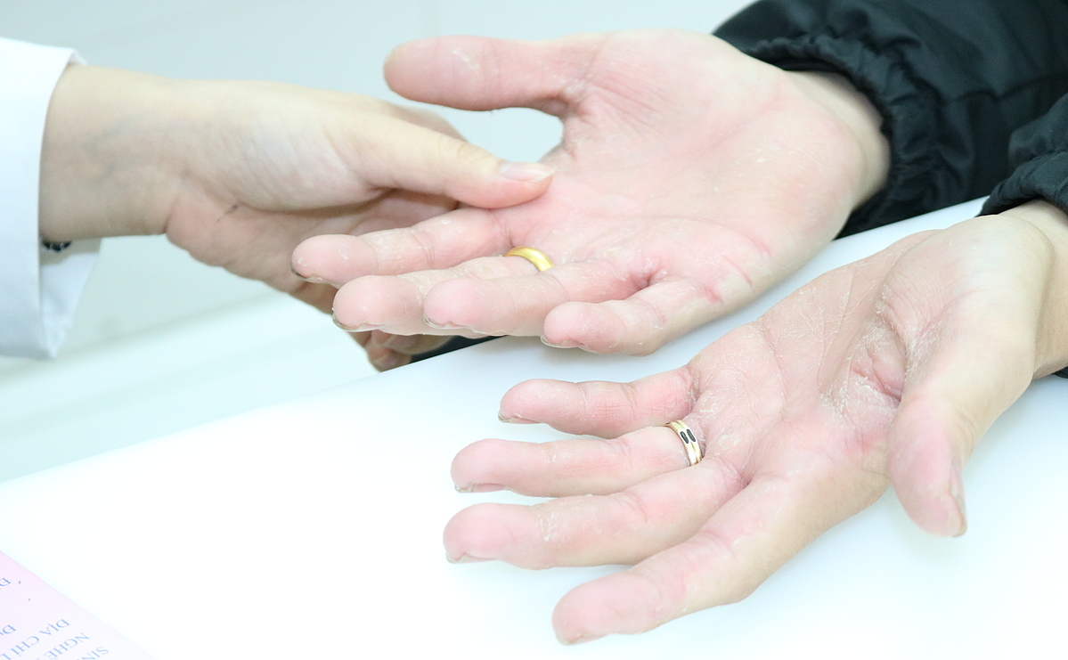 cham-soc-da-tay-trong-mua-dich-covid-19 cham-soc-da-tay-trong-mua-dich-covid-19