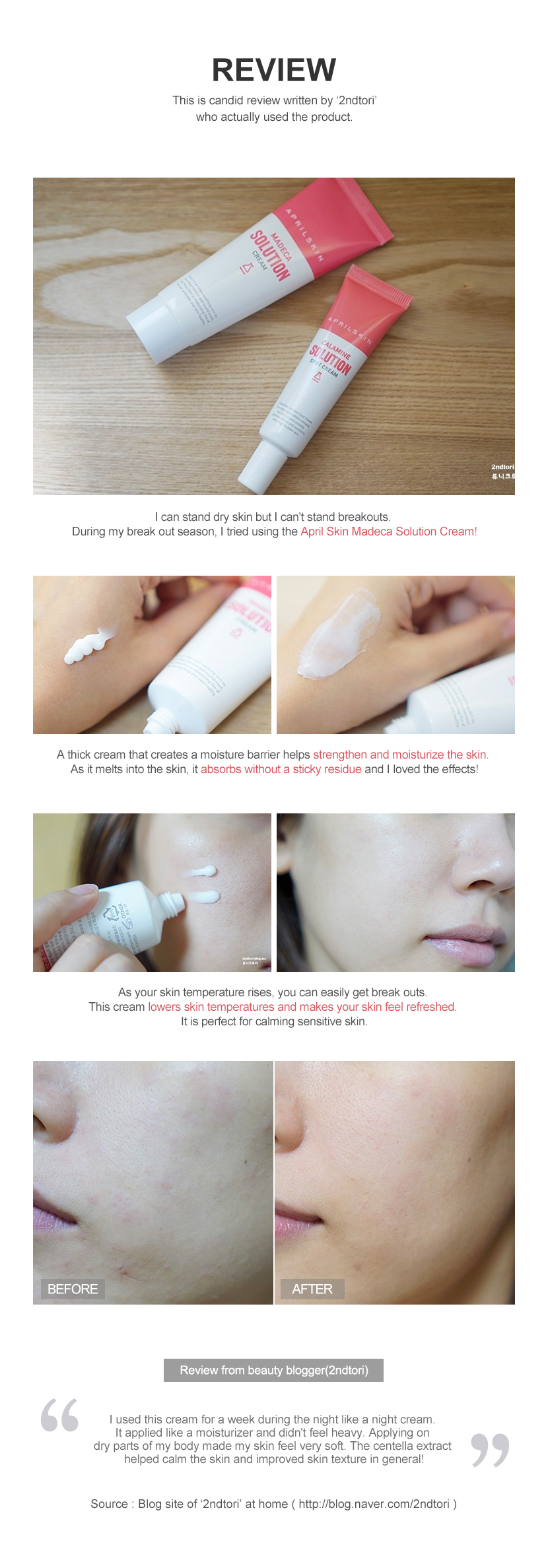 kem-duong-am-danh-cho-da-nhay-cam-aprilskin-madeca-solution-cream kem-duong-am-danh-cho-da-nhay-cam-aprilskin-madeca-solution-cream