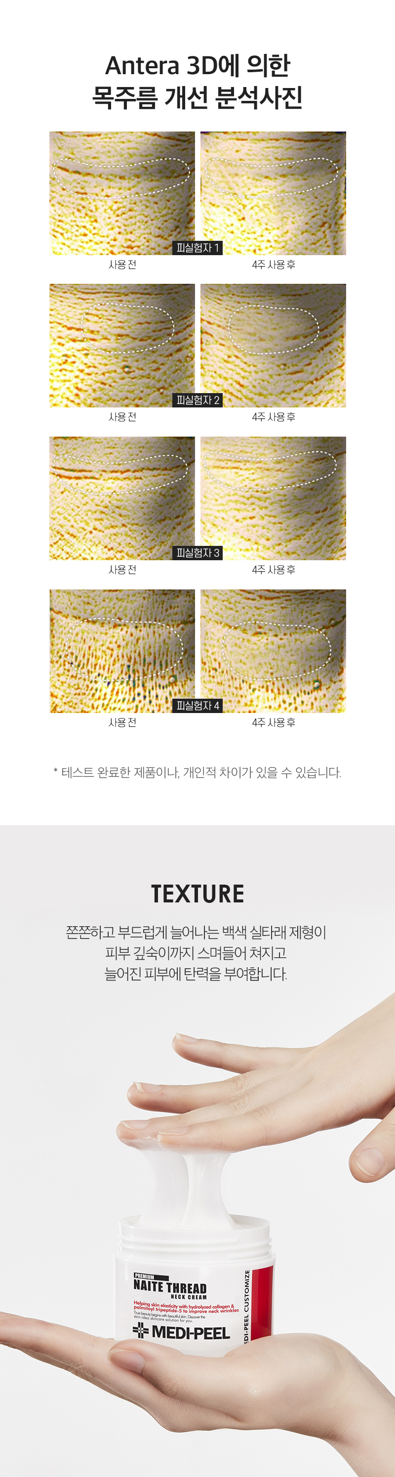 kem-duong-co-medi-peel-naite-thread-neck-100ml kem-duong-co-medi-peel-naite-thread-neck-100ml