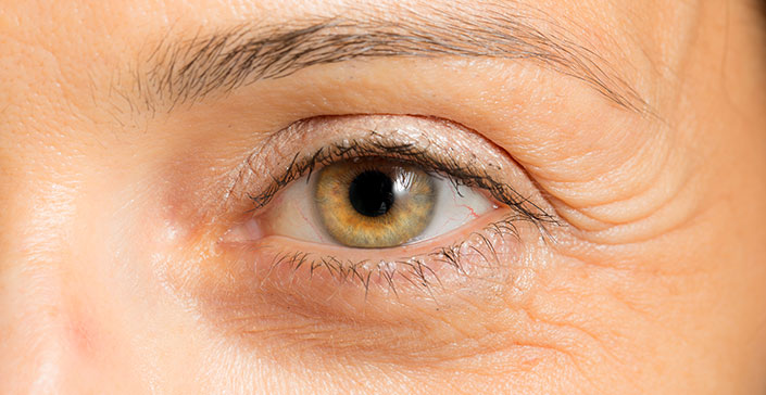 co-nen-su-dung-kem-mat-hay-khong co-nen-su-dung-kem-mat-hay-khong