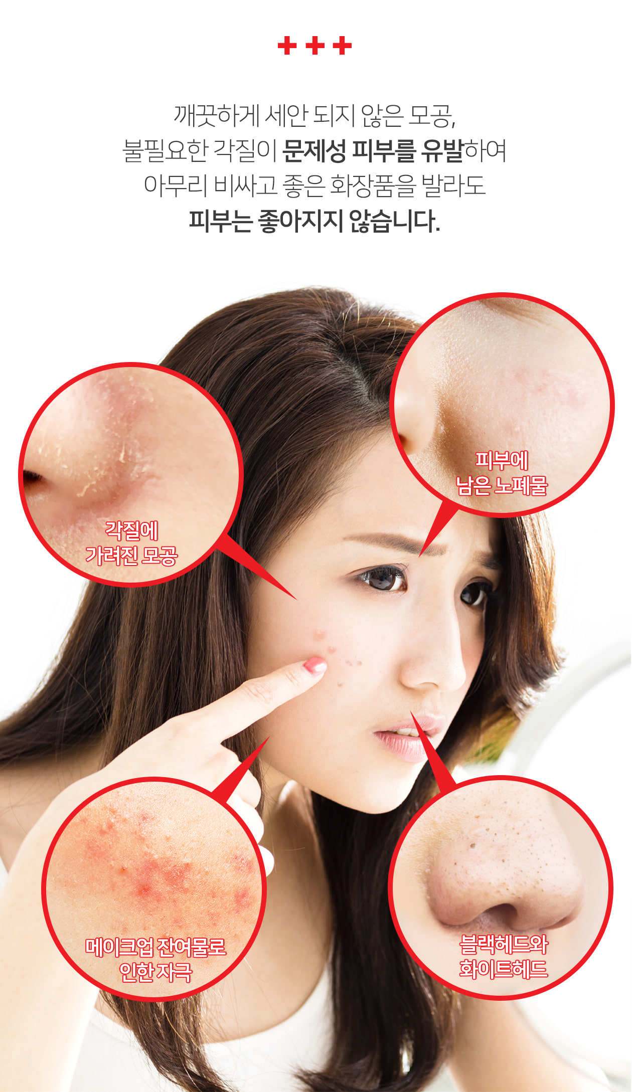 serum-tri-mun-tham-aha-bha-pha-30-days-miracle-cua-some-by-mi serum-tri-mun-tham-aha-bha-pha-30-days-miracle-cua-some-by-mi