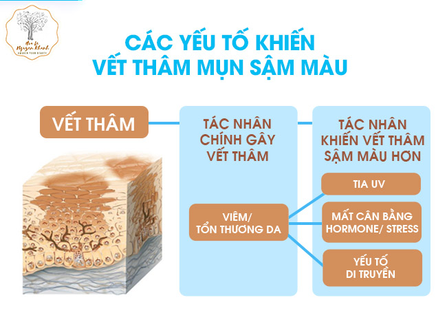 tham-mun-nguyen-nhan-va-cach-khac-phuc-vet-tham-mun tham-mun-nguyen-nhan-va-cach-khac-phuc-vet-tham-mun