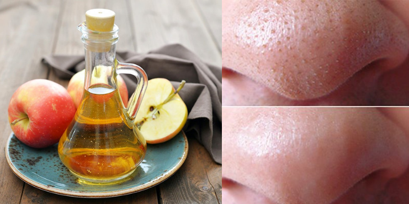 lam-dep-hieu-qua-bang-giam-tao lam-dep-hieu-qua-bang-giam-tao