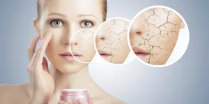 Phần 1: Bạn biết những gì về làn da khô?