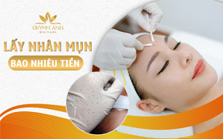 Đi lấy nhân mụn hết bao nhiêu tiền – Quỳnh Anh Beauty & Spa Nha Trang