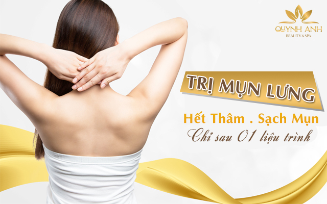 Trị Thâm Mụn Lưng Spa: Giải Pháp Hiệu Quả Cho Làn Da Sáng Mịn