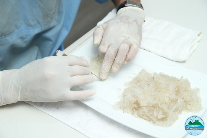 cách làm sạch tổ yến khô cách làm sạch tổ yến khô