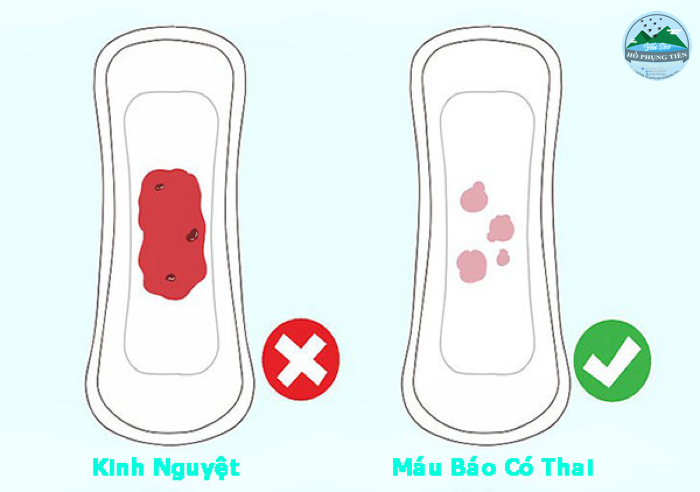 dấu hiệu phụ nữ mang thai dấu hiệu phụ nữ mang thai
