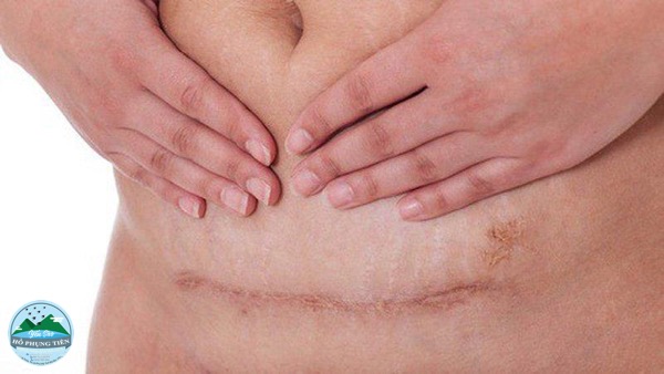 Thức ăn bổ dưỡng cho bà đẻ Thức ăn bổ dưỡng cho bà đẻ