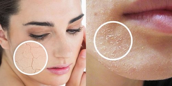 Tắm nước nóng có hại gì không