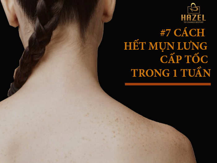 7 CÁCH hết mụn lưng CẤP TỐC chỉ trong môt tuần: Gia công mỹ phẩm 7 CÁCH hết mụn lưng CẤP TỐC chỉ trong môt tuần: Gia công mỹ phẩm